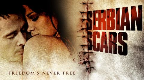 Serbian Scars